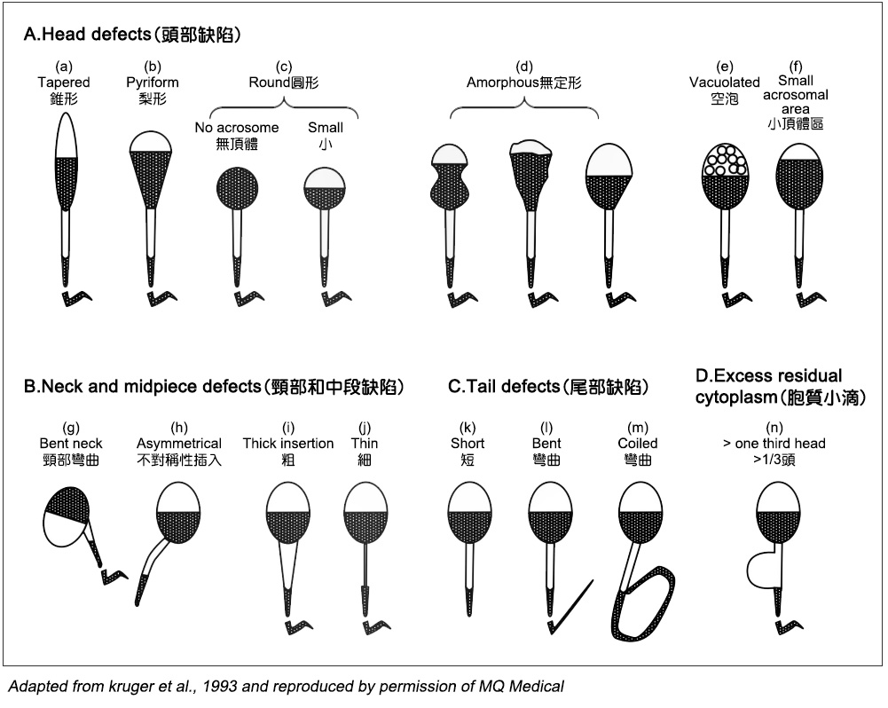 精子型態